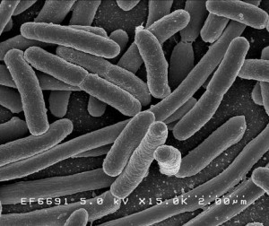 L' Escherichia coli al microscopio elettronico