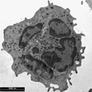 harmful neutrophil credit: Hebrew University of Jerusalem