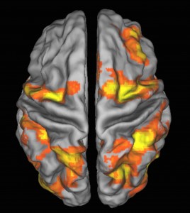 Risonanza magnetica funzionale del cervello durante l’esecuzione dei test: in alto a dx è visibile l’area del giro frontale medio di destra, sede della “centralina” anti-distrazioni. In giallo le aree ad attivazione più intensa.