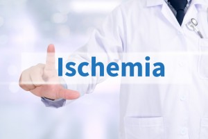 ischemia