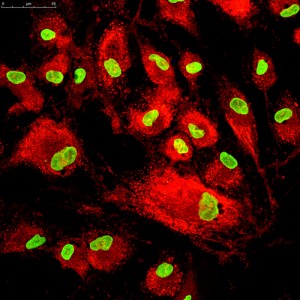 cellule mesenchimali