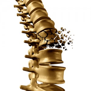 osteoporosi