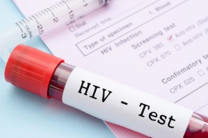 test hiv