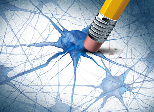 Alzheimer, indagine Lilly: per l’83% dei neurologi la diagnosi precoce è decisiva