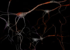 neuroni