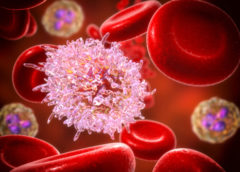 leucemia