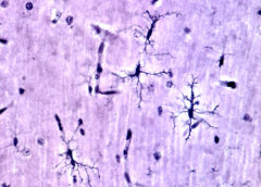 microglia