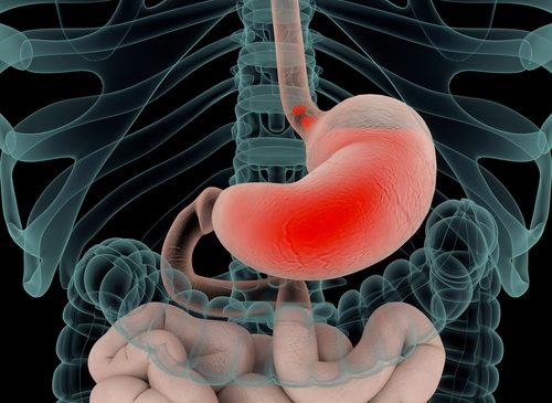 Durvalumab migliora la sopravvivenza nei tumori gastrici e della giunzione gastroesofagea: i dati dello studio MATTERHORN