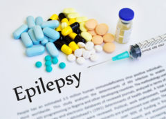 epilessia