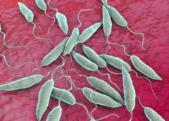 leishmaniasis