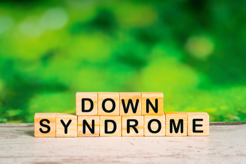 sindrome di down