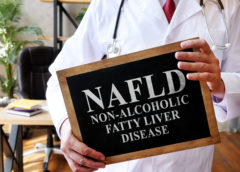 NAFLD fegato