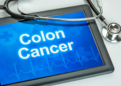 cancro tumore colon