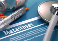 metastasi