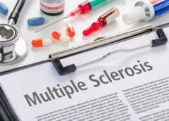 sclerosi multipla