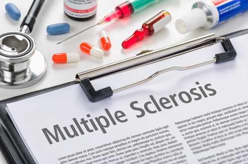 sclerosi multipla