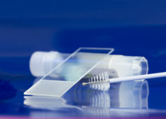HPV test
