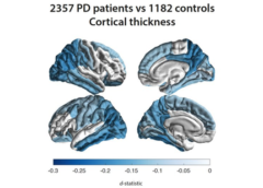 Parkinson