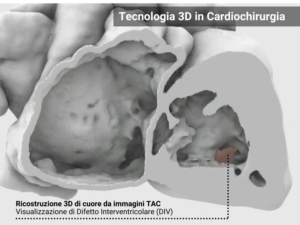 Tecnologia 3D in medicina: strumenti, ambiti applicativi e ricadute cliniche